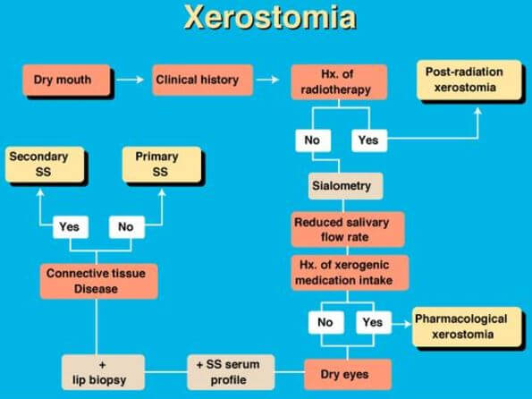 Xerostomia Diagnosis