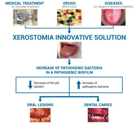 Xerostomia causes risk factors